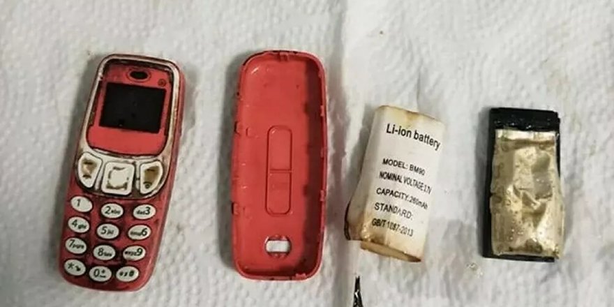 Doktorları şaşırtan ameliyat: Midesinden Nokia 3310 çıktı