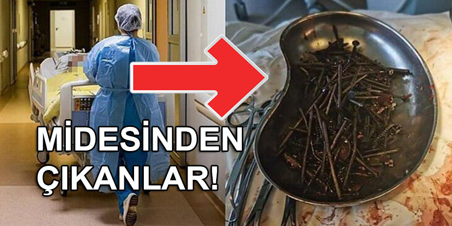 Midesinden 1 kilogramdan fazla çivi, vida ve bıçak çıkarıldı