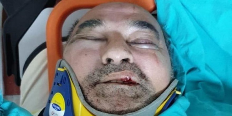 Kuşadası Belediyesi'nin usulsüz ihalesini gündeme getiren Gazeteci Ergün Poyraz öldüresiye dövüldü!