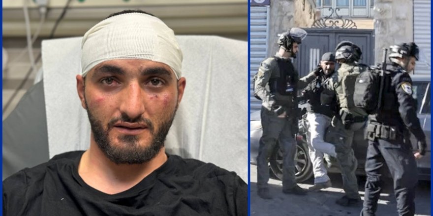 İsrail güçleri, AA foto muhabirini Doğu Kudüs'te görevi sırasında darbetti