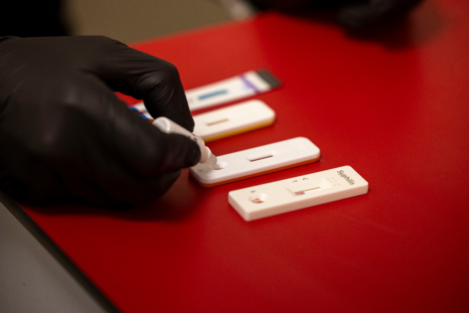 Büyükşehir’den kimliksiz ve ücretsiz test hizmeti