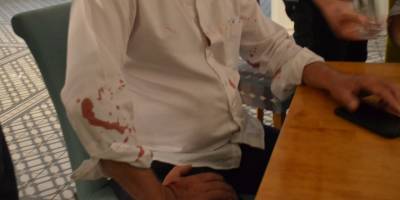 Didim Belediye Başkanına beyzbol sopalı saldırı