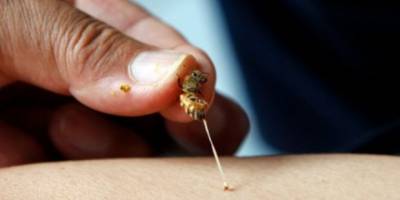 Arı zehri ciltte yaşlanma karşıtı etki gösteriyor