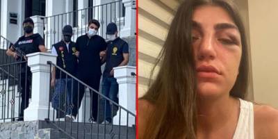 Ünlü mankeni öldüresiye döven eski sevgilisi tutuklandı