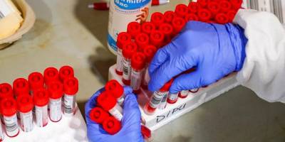 Kuzey Kıbrıs'ta aşısız kişilerin PCR testleri ücretli olacak