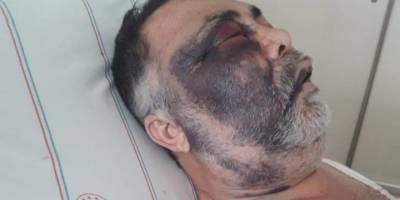 Darp edilen yüzde 90 engelli vatandaş olayında tutuklama kararı