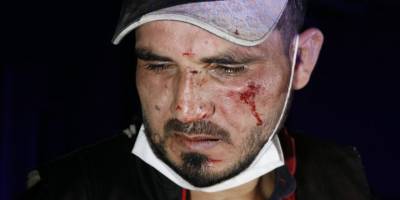 Köpek havlayınca vatandaşlar hırsızı yakaladı, ardından öldüresiye darp etti