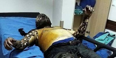 CHP’li belediye ölüme sürükledi