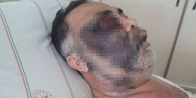 Antalya'da darp edilen engelli adamdan acı haber