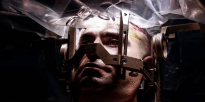 Guinness rekortmeni Doç. Dr. Ali Zırh, 1.000’inci Parkinson ameliyatını yaptı