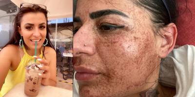 İNTERNETTE ÖNÜNE ÇIKAN GÜZELLİK SALONU İLANI YÜZÜNÜ YAKTI