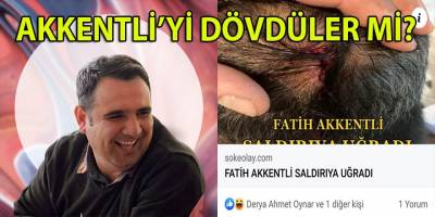 Çerçioğlu'nun sadık elemanı Akkentli saldırıya mı uğradı?