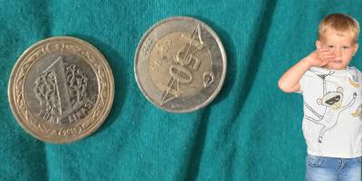 Küçük Miraç'ın yemek borusundan iki metal para çıkarıldı