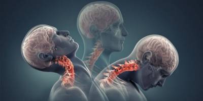 Ameliyatsız boyun fıtığı tedavisi mümkün