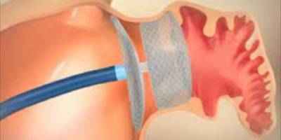 Kütahya’da kalp kaynaklı felç risklerine karşı tıpa uygulaması yapılmaya başlandı