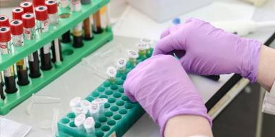 Aynı anda 3 hastalığı tespit eden yerli tanı kitinin hastanelerde kullanımı başlıyor