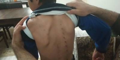 10 yaşındaki çocuğu tırmıkla yaraladı