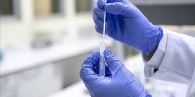 Fransa’da tatil sezonunun Kovid-19’un yeni varyantı Eris’in yayılımını artırdığı düşünülüyor