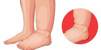 Invamed'den "derin ven trombozuna dikkat" açıklaması