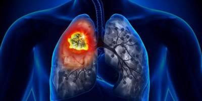 Sağlıkta 'benzersiz' umut ışığı: 'Kanser savar protein' dönemi başlıyor