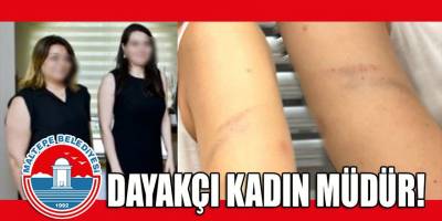 Belediyede dayak skandalı! Kadın müdür, kadın çalışanını dövdü...