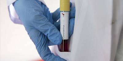 Türkiye'de koronavirüsten 176 kişi hayatını kaybetti, yeni vaka sayısı 40 bin 806