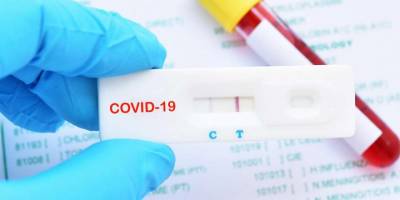 Kovid-19’u 5 dakikada saptayabilen test metodu bulundu