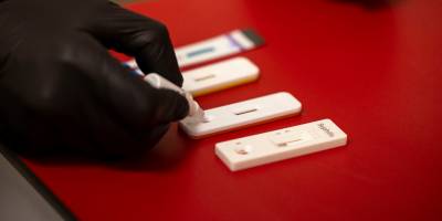 Büyükşehir’den kimliksiz ve ücretsiz test hizmeti