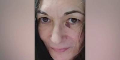 Epstein'in suç ortağı Maxwell'in fotoğrafı yayınlandı: Sol gözünde morluk var